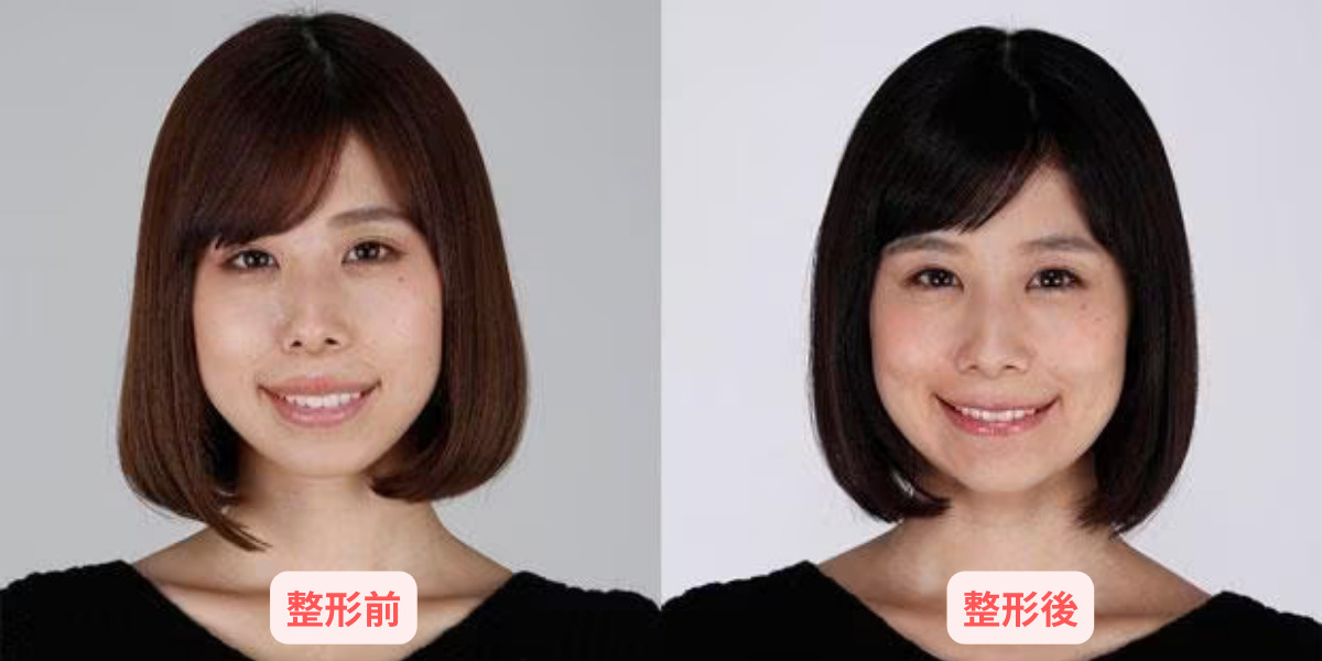 【画像】有村藍里の整形前後が別人?手術前と後の顔を写真で比較! | StarryInsightHub